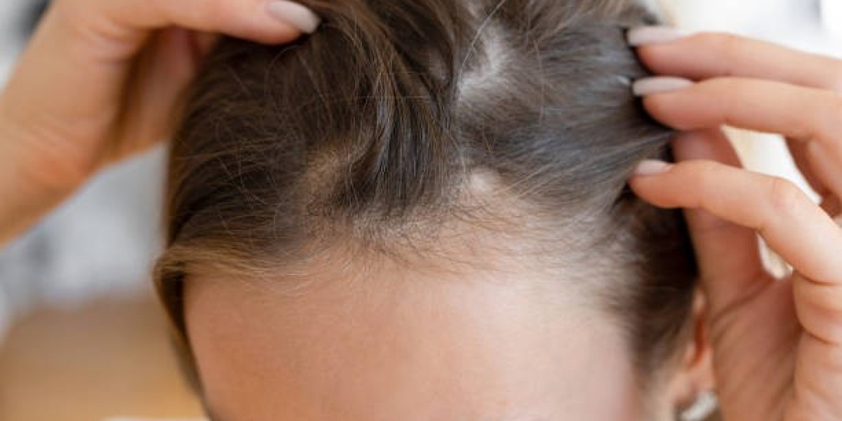 Corrective Hair Transplant Surgery: Addressing Past Failures in Riyadh