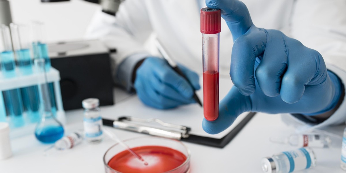 Affordable & Convenient Blood Test at Home in Bengaluru | Full Guide 2025