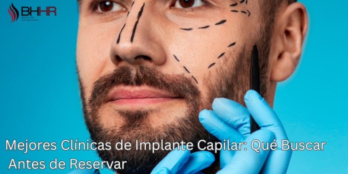 Mejores Clínicas de Implante Capilar: Qué Buscar Antes de Reservar