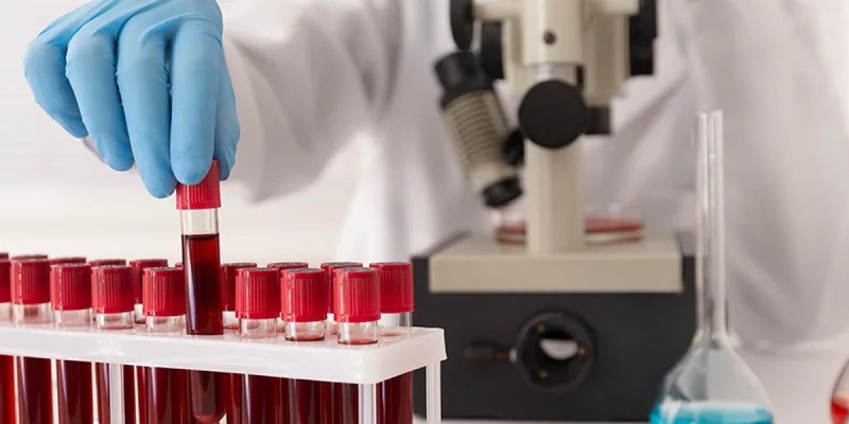 Iron Deficiency Test: Preventive Health for Busy Urban Lives