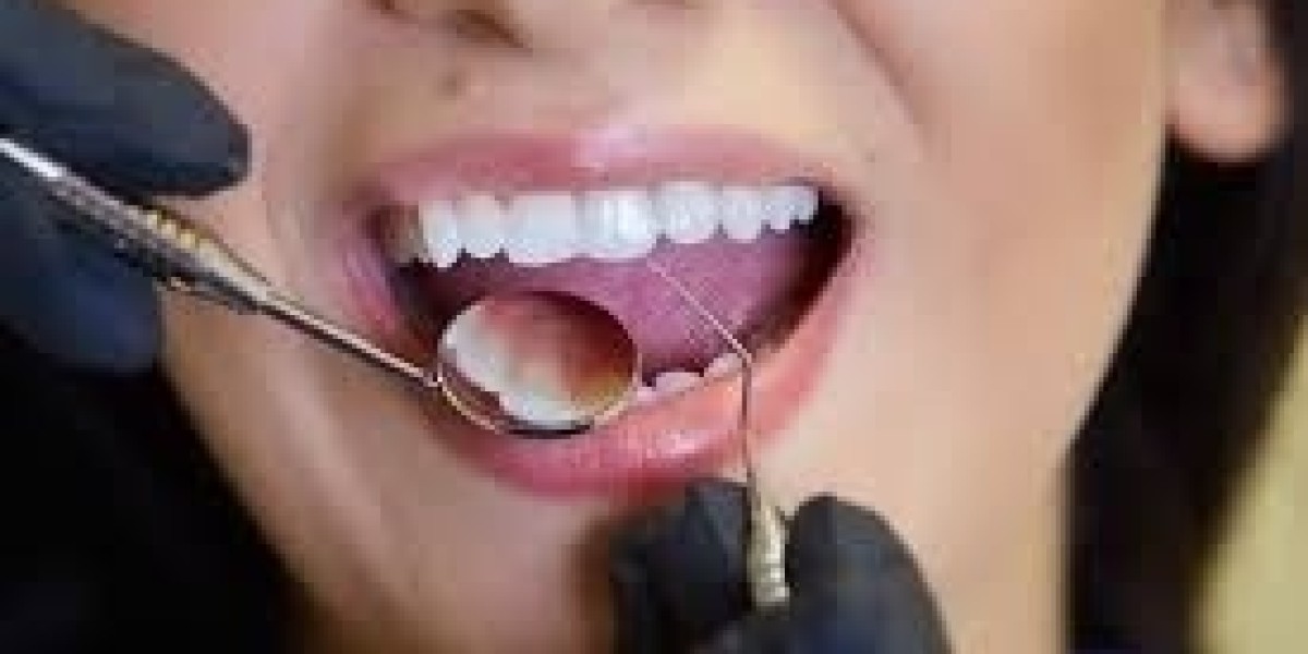 Cosmetic Dental Options That Enhance Teeth and Smile