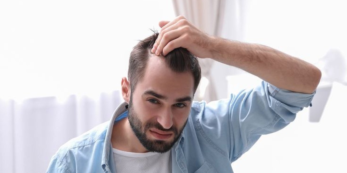 Is FUE Hair Transplant Treatment Worth It?