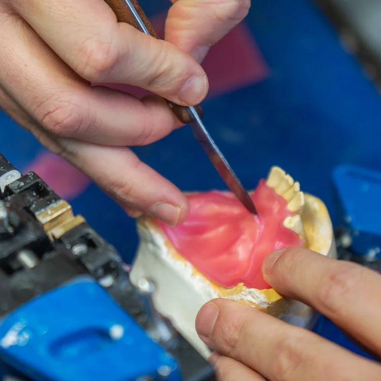 Quick and Cheap Tooth Fixes for Hamilton Patients | Rumor...