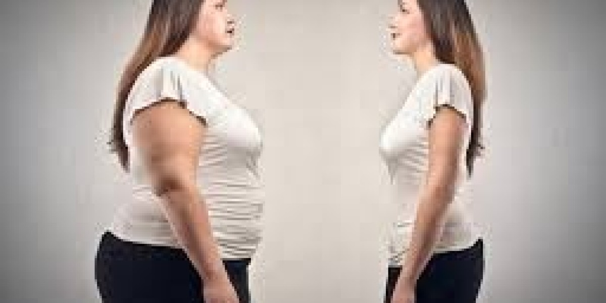 Is Liposuction in Riyadh Right for Men? Targeted Fat Removal Insights