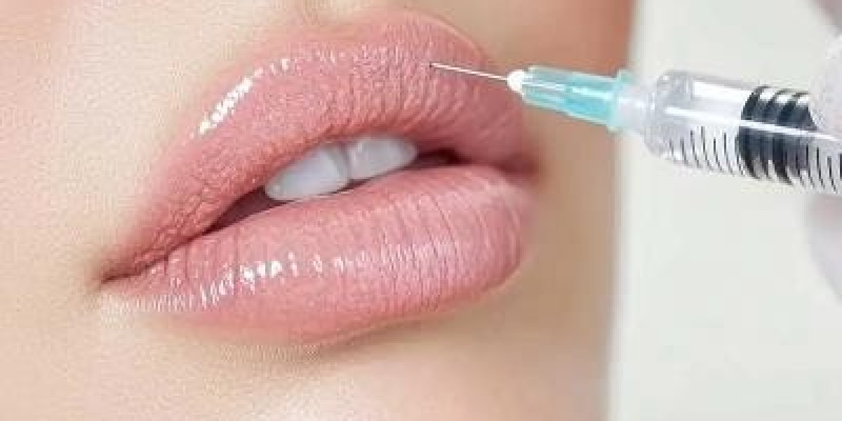 Are Russian Lip Fillers Safe and Appropriate for Every Lip Type?