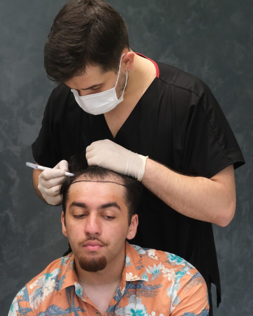DHI Hair Transplant in Turkey | Direct Hair Implantation - UniquEra