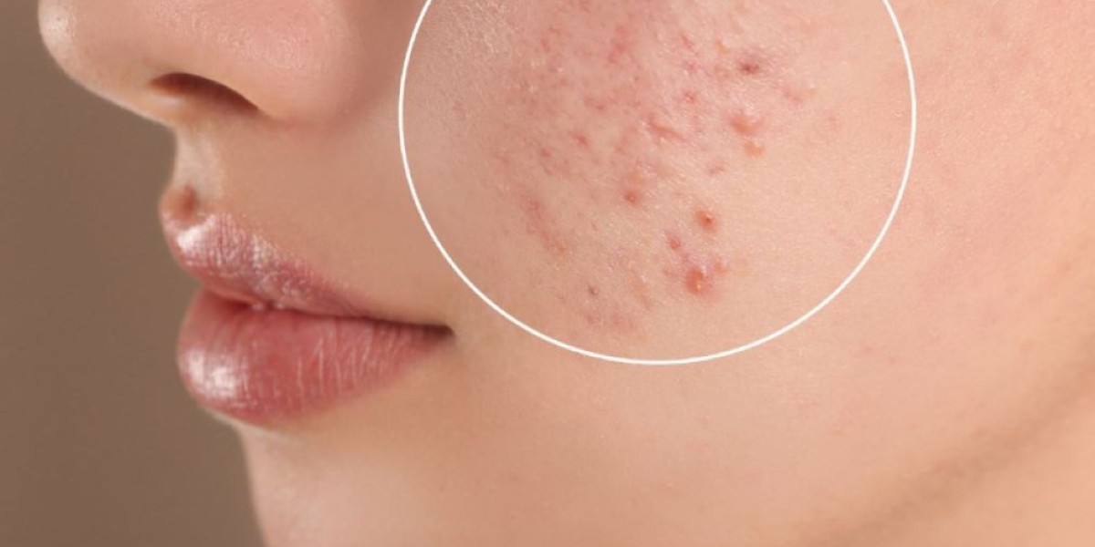 Tips for Faster Healing After Scar Removal in Dubai