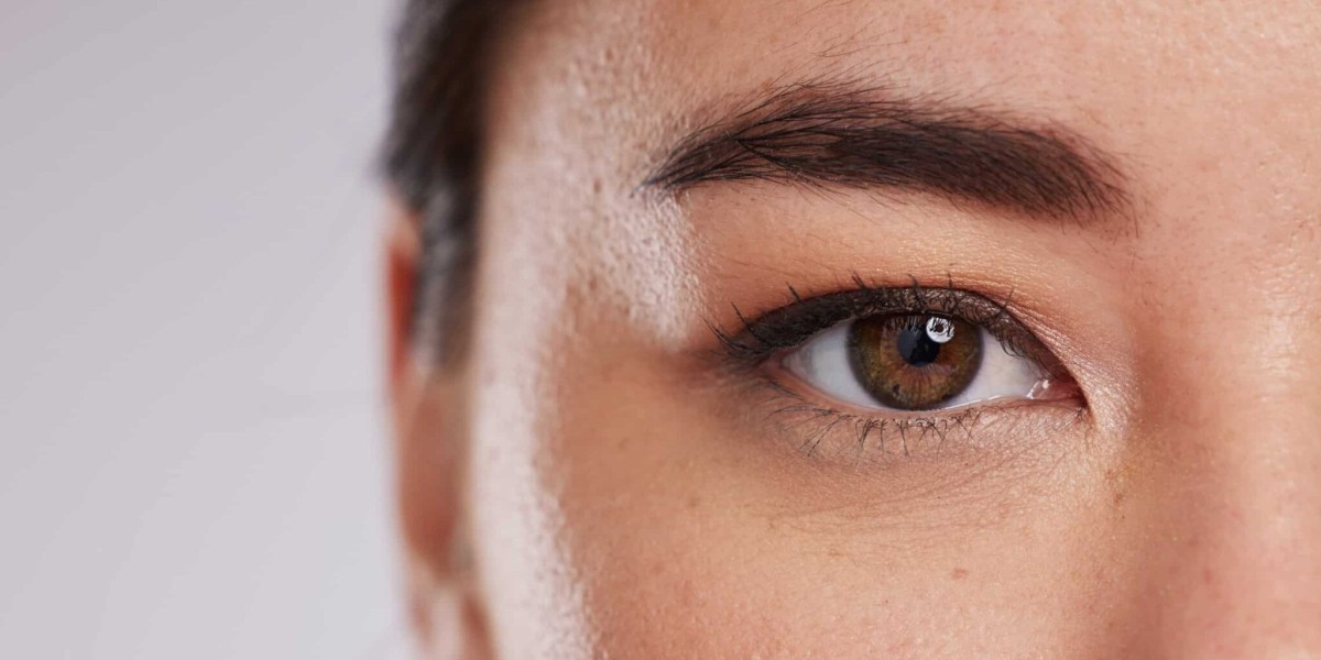 Upper Blepharoplasty Dubai: Lift Droopy Upper Eyelids