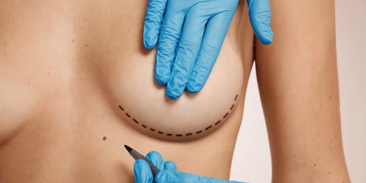 Affordable Breast Lift in Dubai: Safe Options Without Compromising Quality