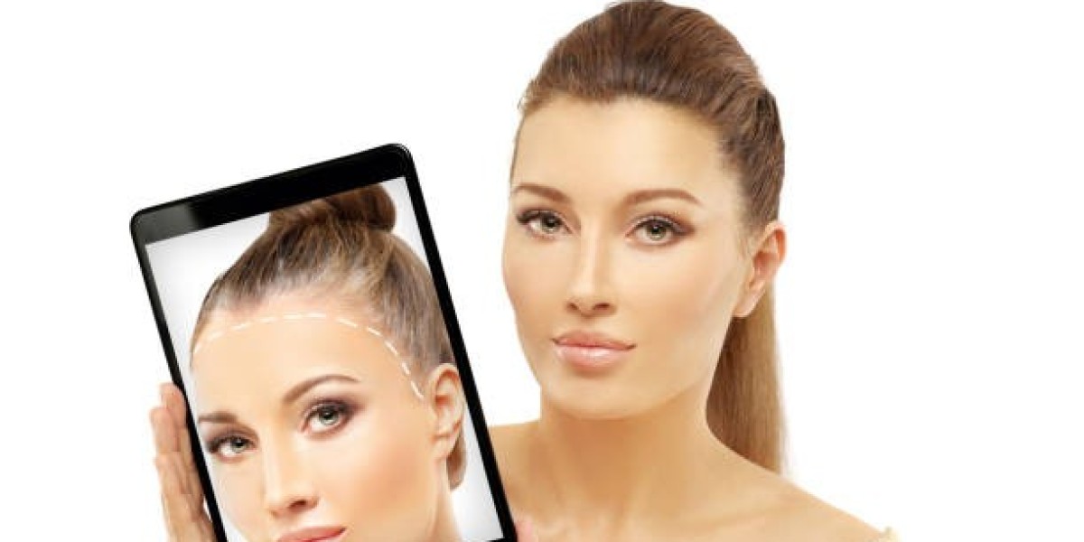 FUE Hair Transplant in Dubai Ideal for Receding Temples