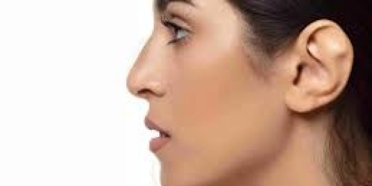 Otoplasty in Jeddah Achieve Perfectly Shaped Ears for Facial Harmony