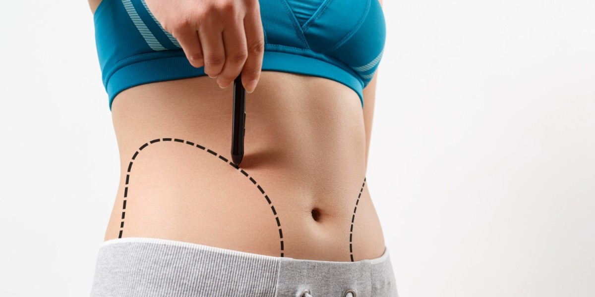 Best Liposuction Surgeon in Dubai for Safe and Effective Liposuction