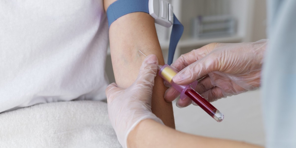 Why Many Trust Blood Test At Home Today