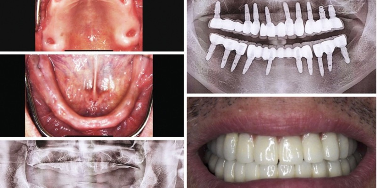 Norcross Dental Care You Can Trust: Complete Family Dentistry at Berkeley Lake Dental