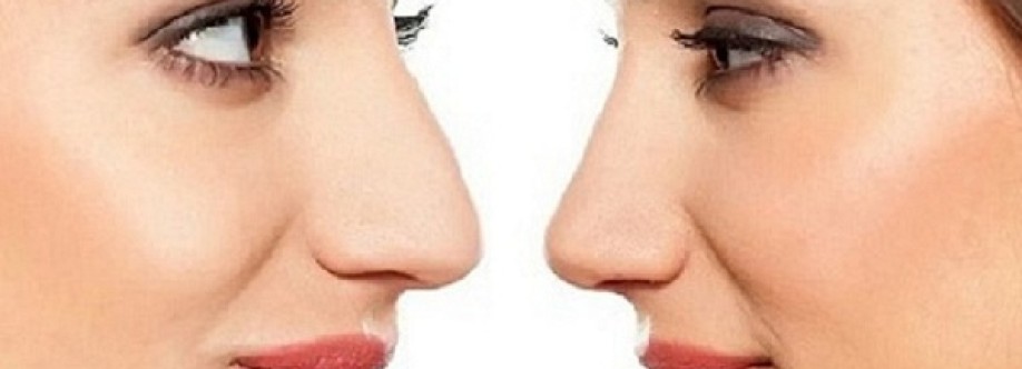 La rinoplastica in Ospedale Cover Image